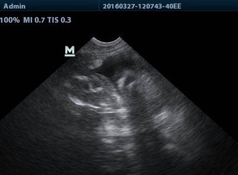 How well do you read Ultrasound?